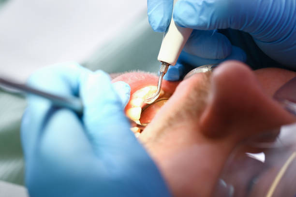 Best Walk-In Emergency Dental Services in Nevada City, CA