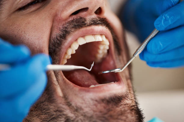 Best Urgent Dental Care for Toothaches in Nevada City, CA